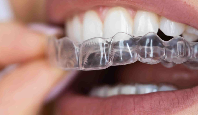 Sagalign — Custom Orthodontic Excellence